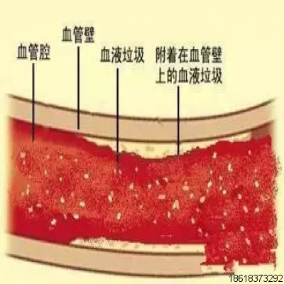 最近火爆的“換血療法”究竟是什么？